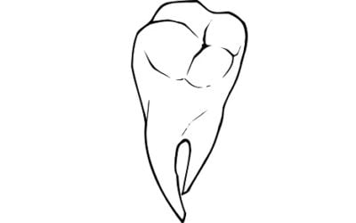 10 ciekawostek o zębach mądrości