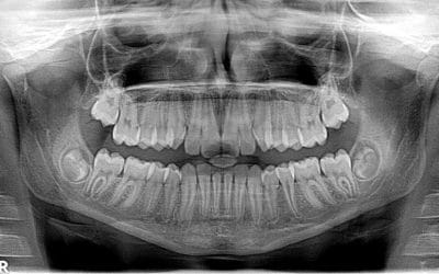 Pracownia RTG Kraków – co warto wiedzieć?