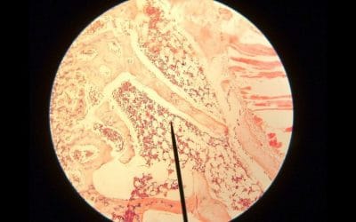 10 ciekawostek o szpiku kostnym