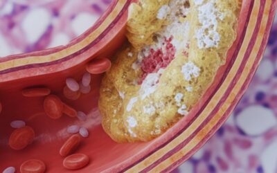 20 ciekawostek o cholesterolu