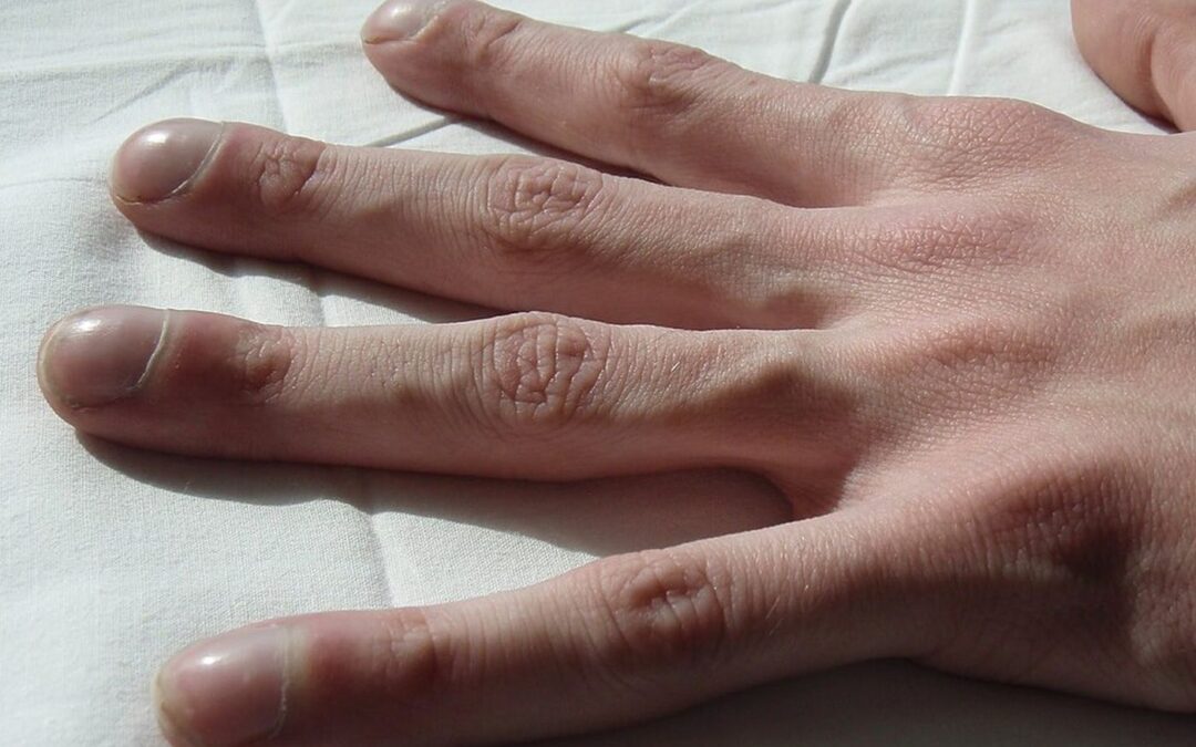 14 ciekawostki o mukowiscydozie