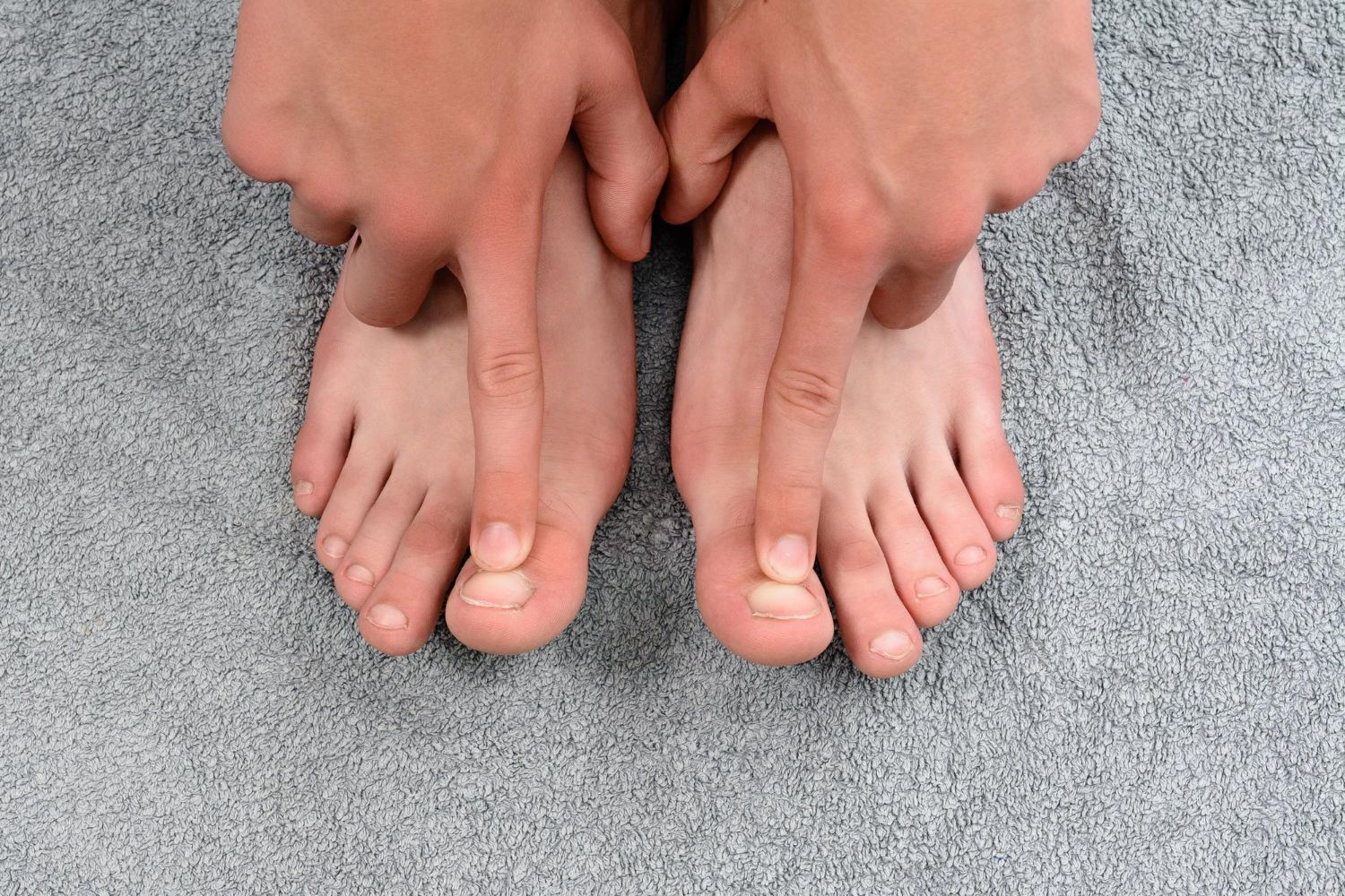 ​hallux valgus