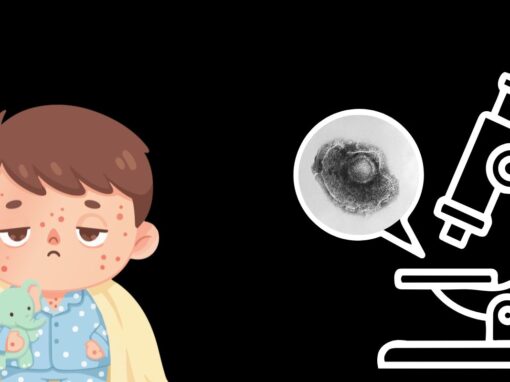 17 ciekawostek o ospie wietrznej