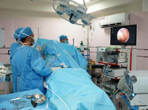 14 ciekawostek o laparoskopii