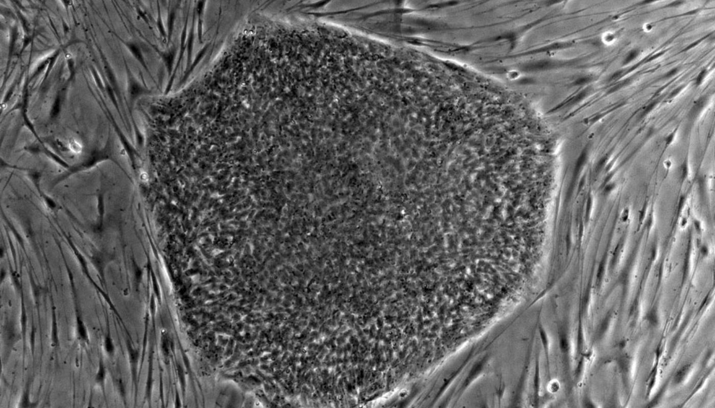 komórki macierzyste