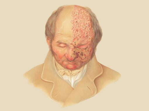 14 ciekawostek o półpaścu