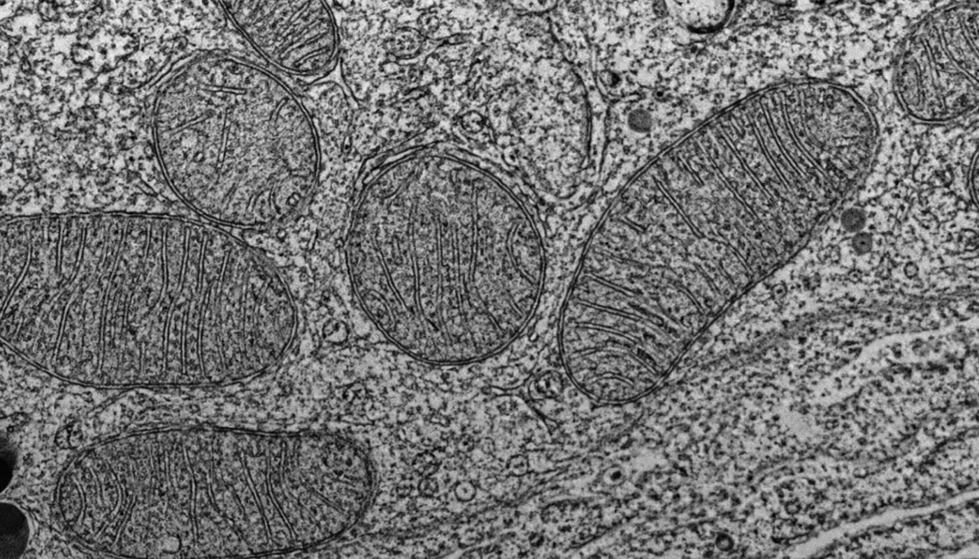 mitochondria