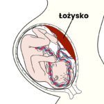 łożysko