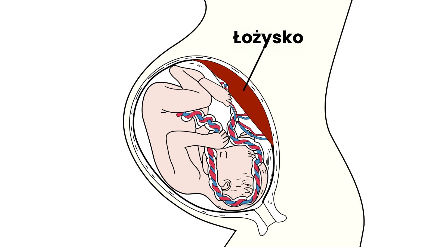 łożysko